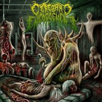 Cerebral Engorgement - Gastrointestinal Bleeding (2013)
