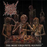Mindly Rotten - The Most Exquisite Agonies (2005)