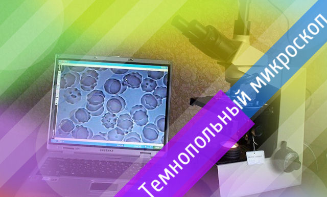 Темнопольный микроскоп для гемосканирования Темнопольный микроскоп для гемосканирования