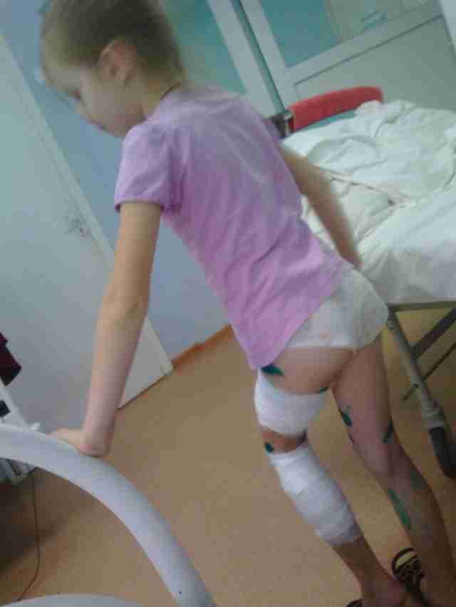 «У неё были горящие мутные глаза». Монолог женщины, на детей которой напала бойцовская собака